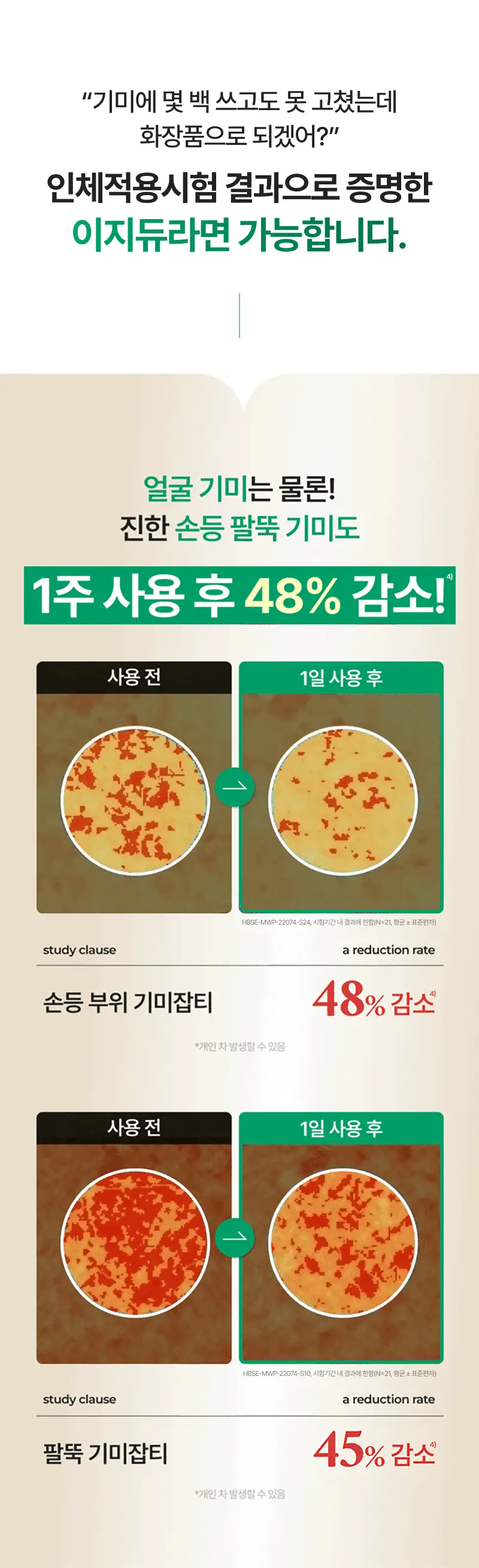 [기미개선] 대웅제약 이지듀 기미잡티앰플 12ml+1ml 기획 상세페이지 2